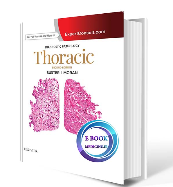 دانلود کتاب Diagnostic Pathology: Thoracic 2nd Edition 2017